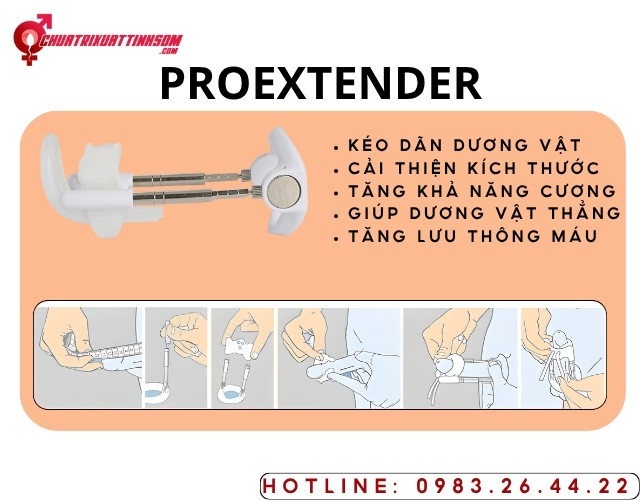 Dụng cụ kéo dài, tăng kích thước chu vi dương vật