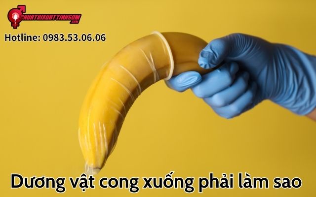 Dương vật cong xuống phải làm sao