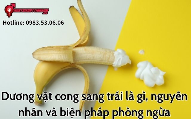 Dương vật cong sang trái là gì
